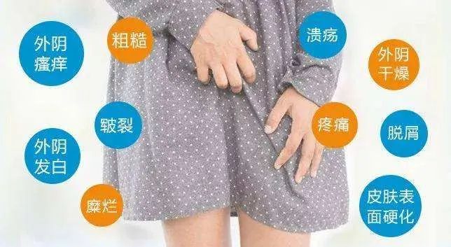 外阴白斑会传染吗？