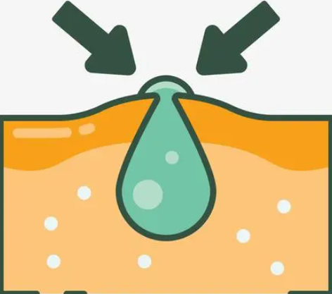 竹白霜加茶油这种偏方可以治疗外阴白斑吗? 竹白霜加茶油这种偏方可以治疗外阴白斑吗?